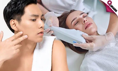 Morpheus Skin Tightening Treatment for Face & Neck!